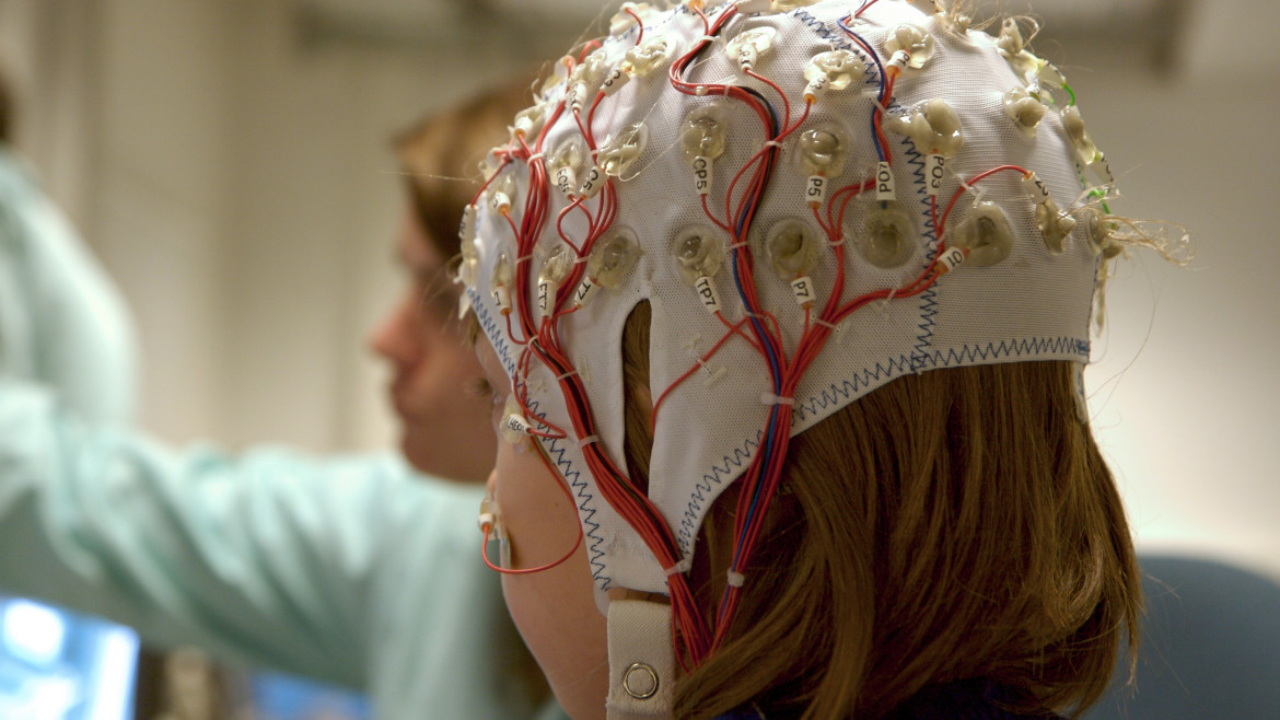 26 Million Epilepsy Patients Could Benefit from Medical Marijuana